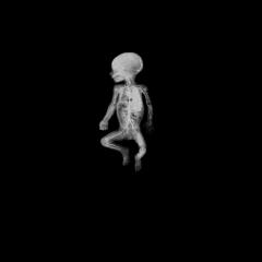 人体结构 - qrqnni42xtYxBd5zEPtWm1XKV2m.jpg