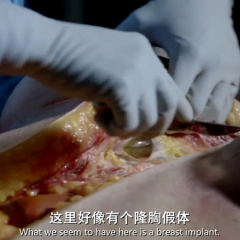 肥胖症：尸检 - 834d48d62d14effbs.png